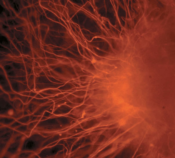 Mature cells such as these neurons develop from immature pluripotent cells.