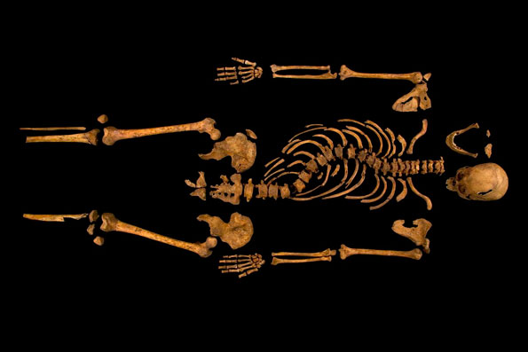 Skeleton of King Richard III showing his curved spine.