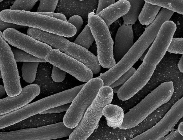 Electron microscope image of bacteria.