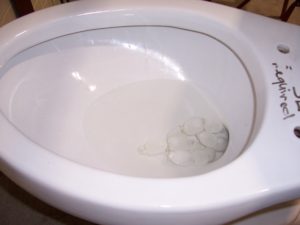 a toilet bowl with some blobby white snake things in it.