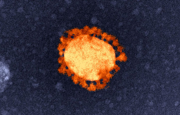 A coronavirus capsule, stained orange